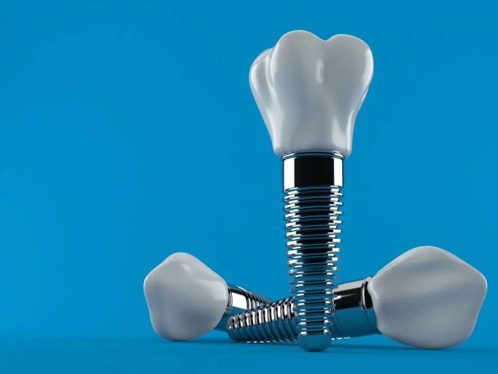 Implanty zębów Poznań